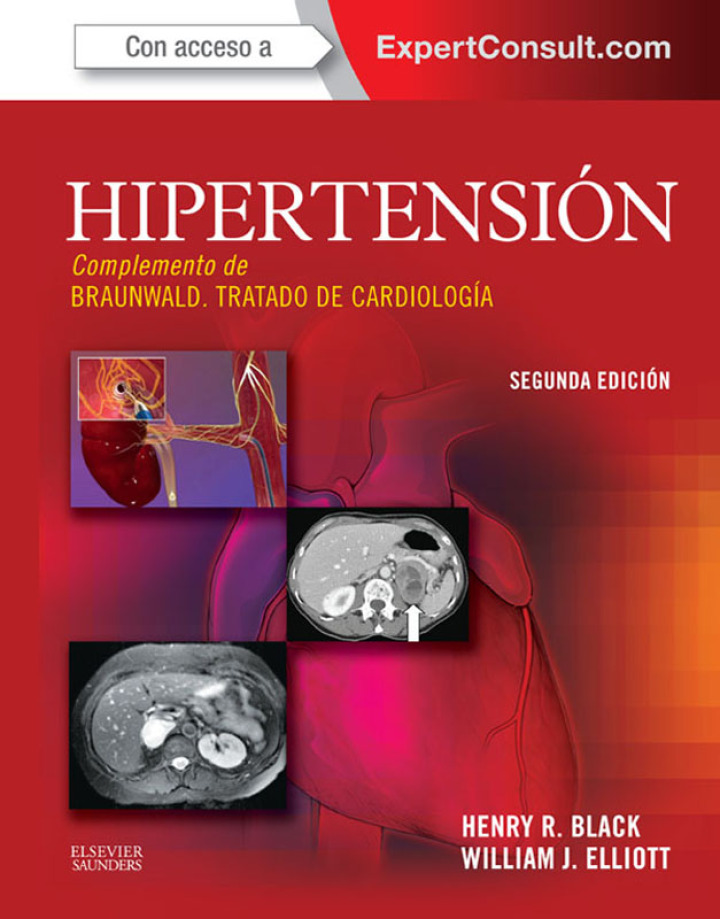 Hipertensi�n ebook