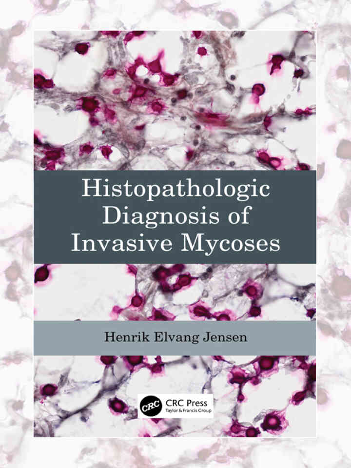 Histopathologic Diagnosis of Invasive Mycoses ebook