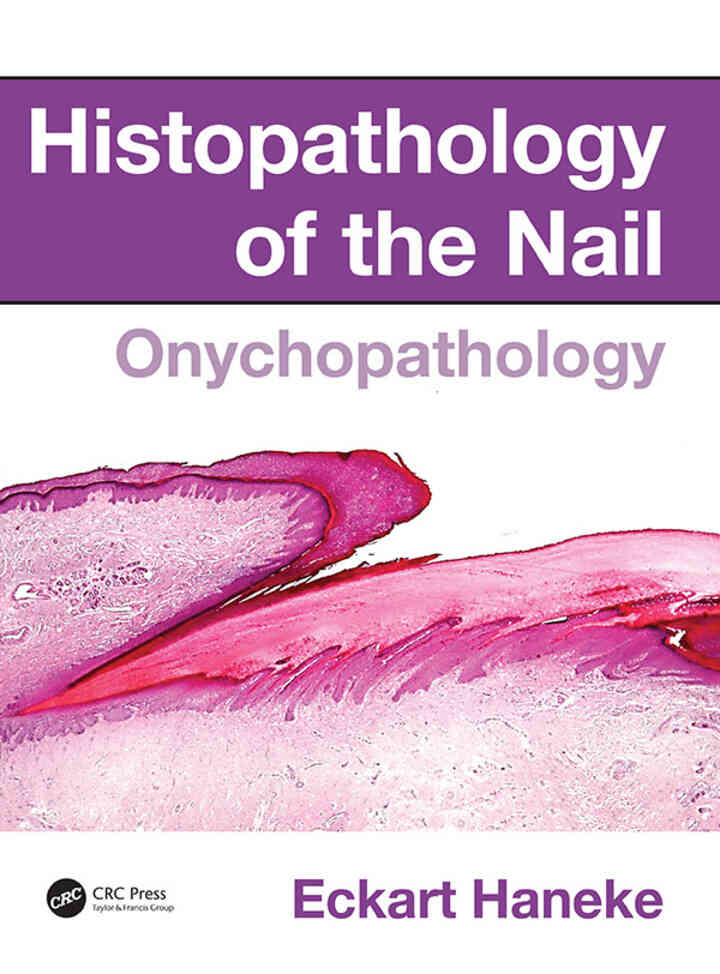 Histopathology of the Nail: Onychopathology ebook