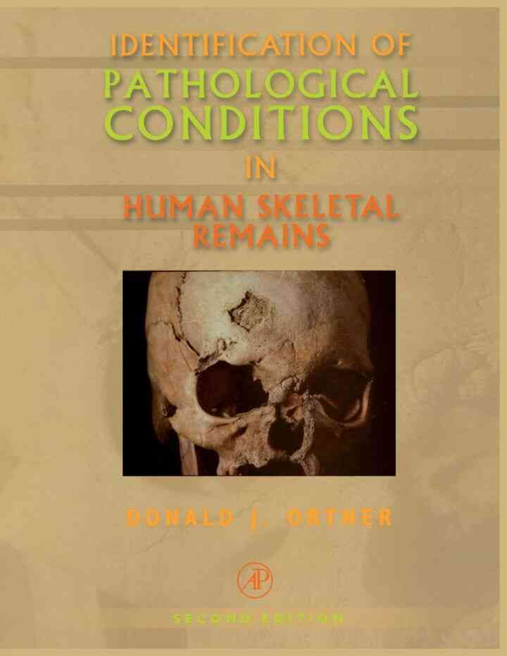 Identification of Patholog in Human Skeletal Remains ebook