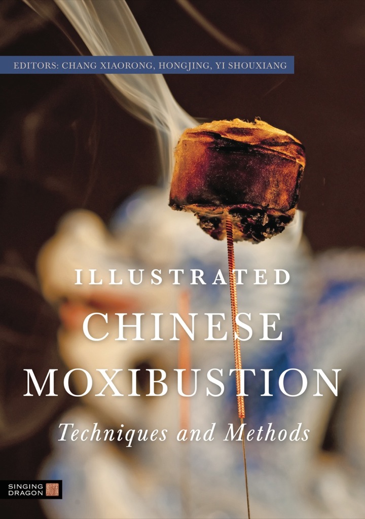 Illustrated Chinese Moxibustion Techniques and Methods ebook