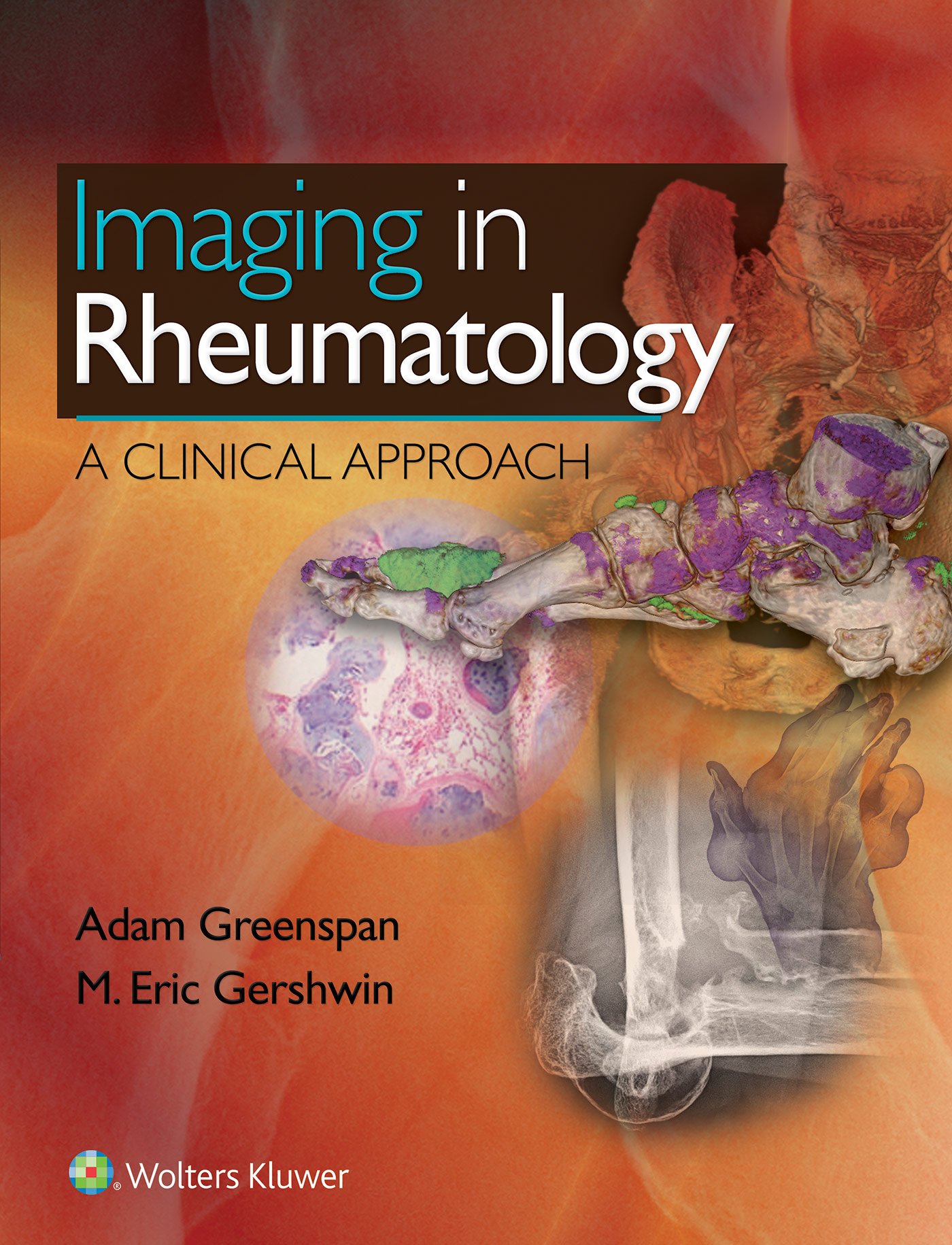 Imaging in Rheumatology: A Clinical Approach ebook
