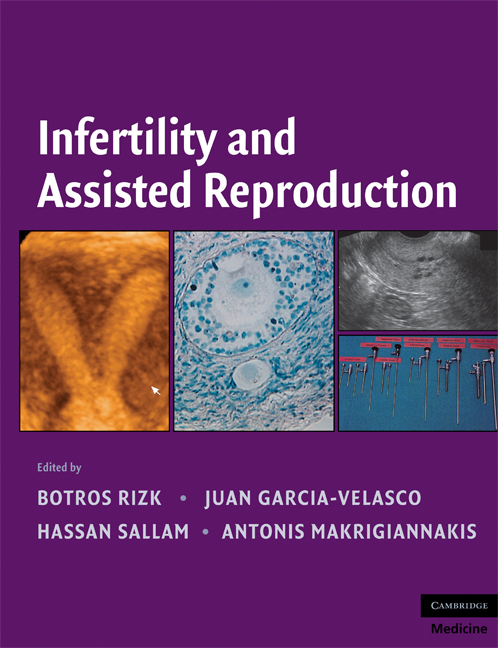 Infertility and Assisted Reproduction ebook