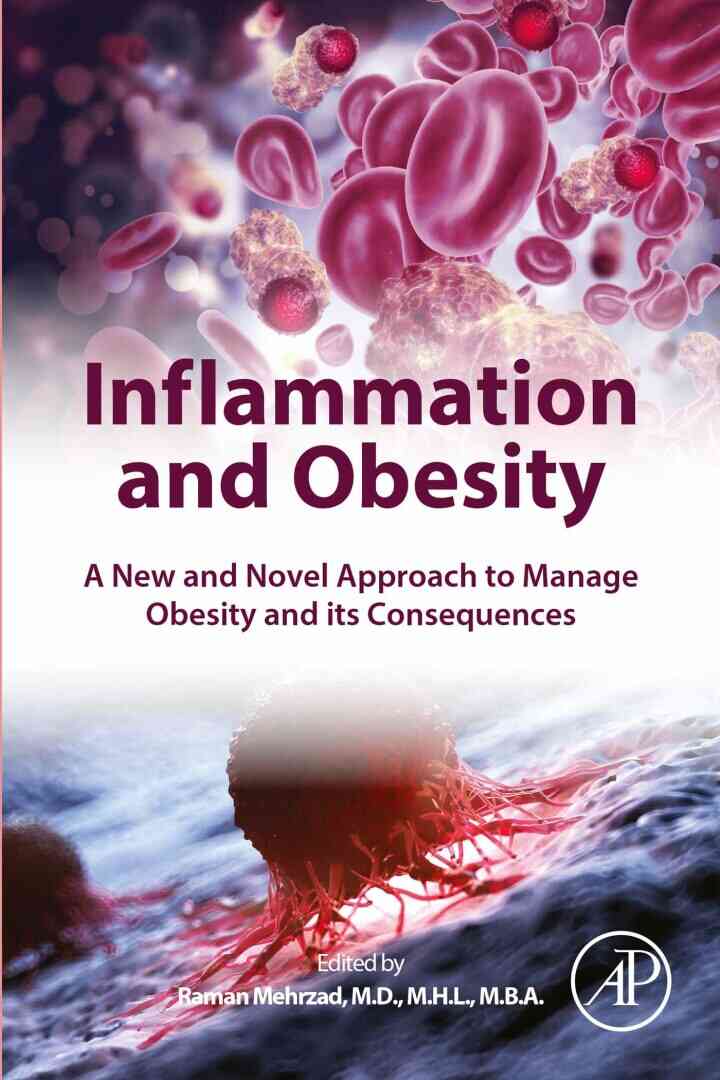 Inflammation and Obesity: A New and Novel Approach to Manage Obesity and its Consequences ebook