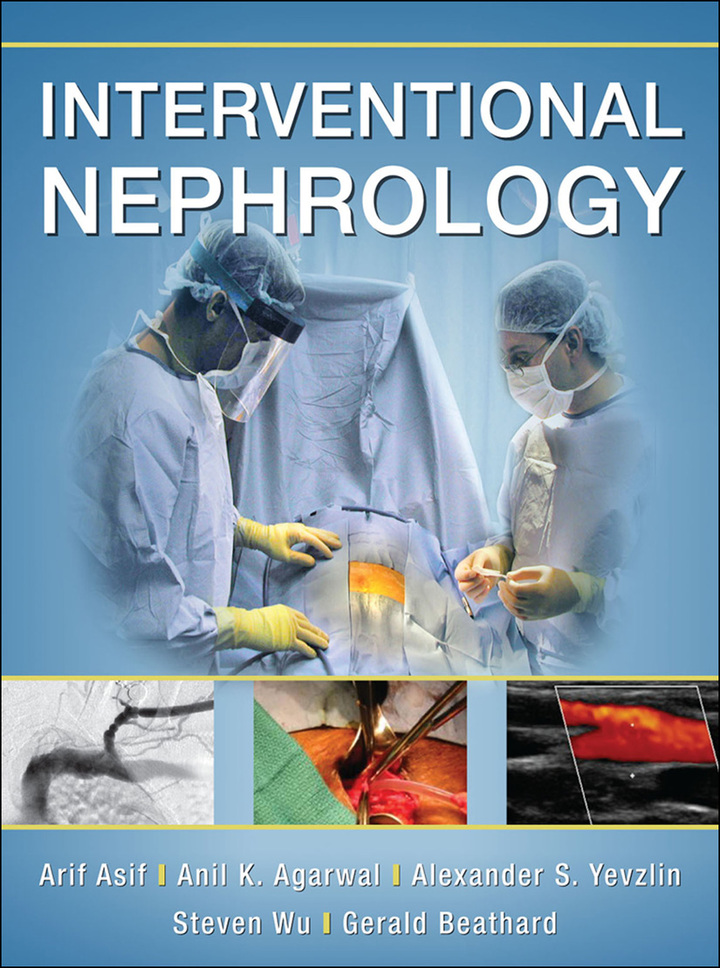 Interventional Nephrology ebook