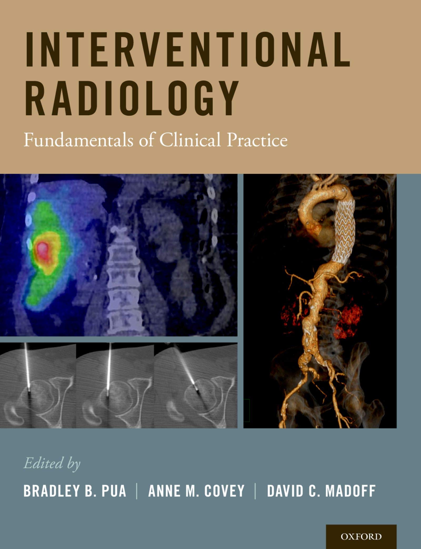 Interventional Radiology: Fundamentals of Clinical Practice ebook