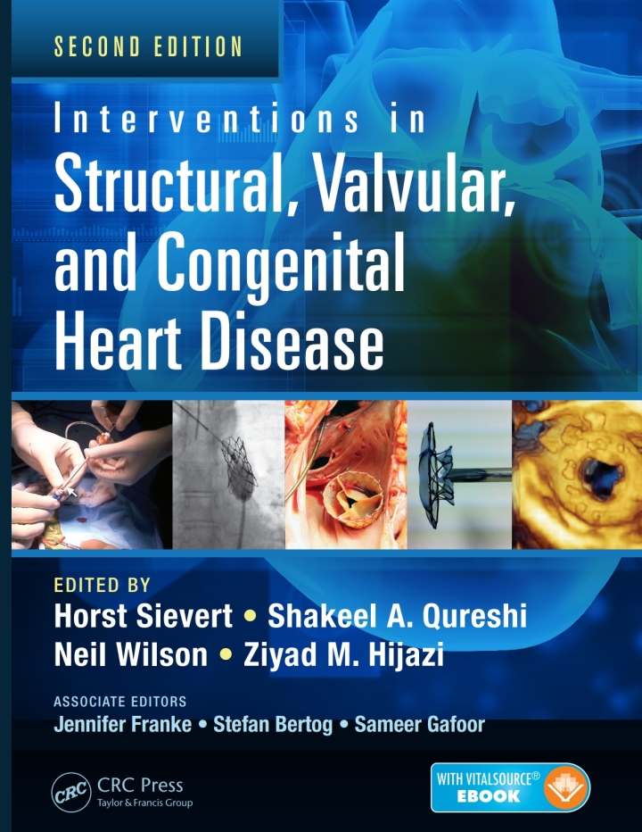 Interventions in Structural, Valvular and Congenital Heart Disease ebook