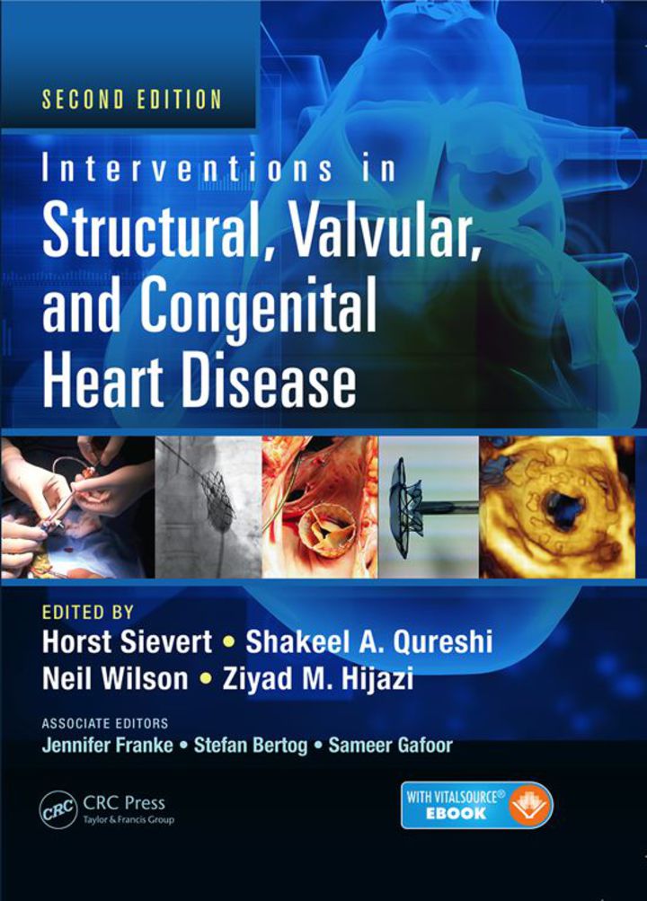 Interventions in Structural, Valvular and Congenital Heart Disease ebook