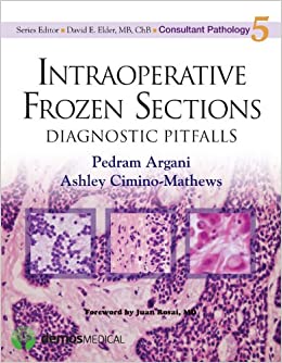 Intraoperative Frozen Sections: Diagnostic Pitfalls (Consultant Pathology Book 5) ebook