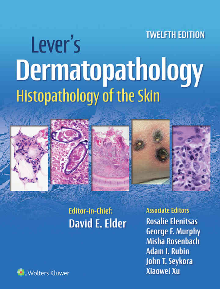 Lever's Dermatopathology Histopathology of the Skin ebook