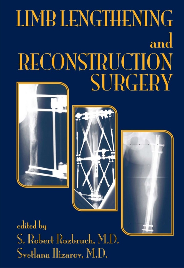 Limb Lengthening and Reconstruction Surgery ebook