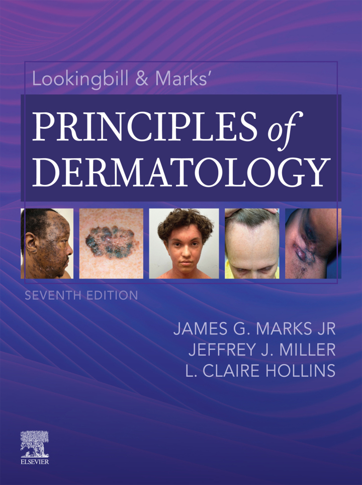 Lookingbill & Marks' Principles of Dermatology ebook