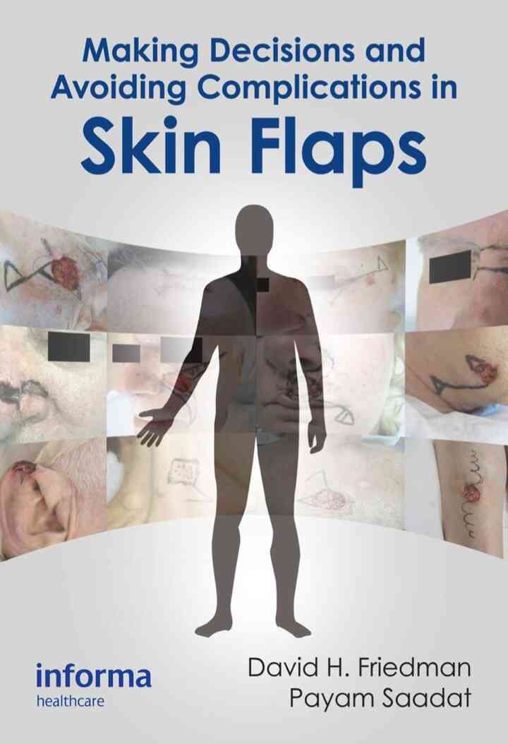 Making Decisions and Avoiding Complications in Skin Flaps ebook