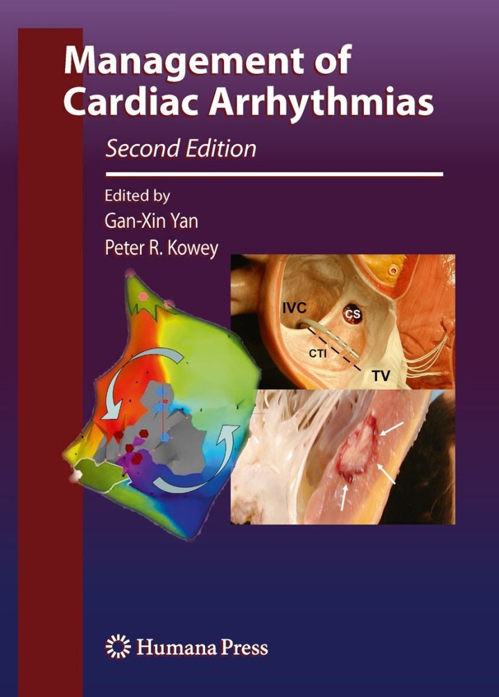 Management of Cardiac Arrhythmias ebook