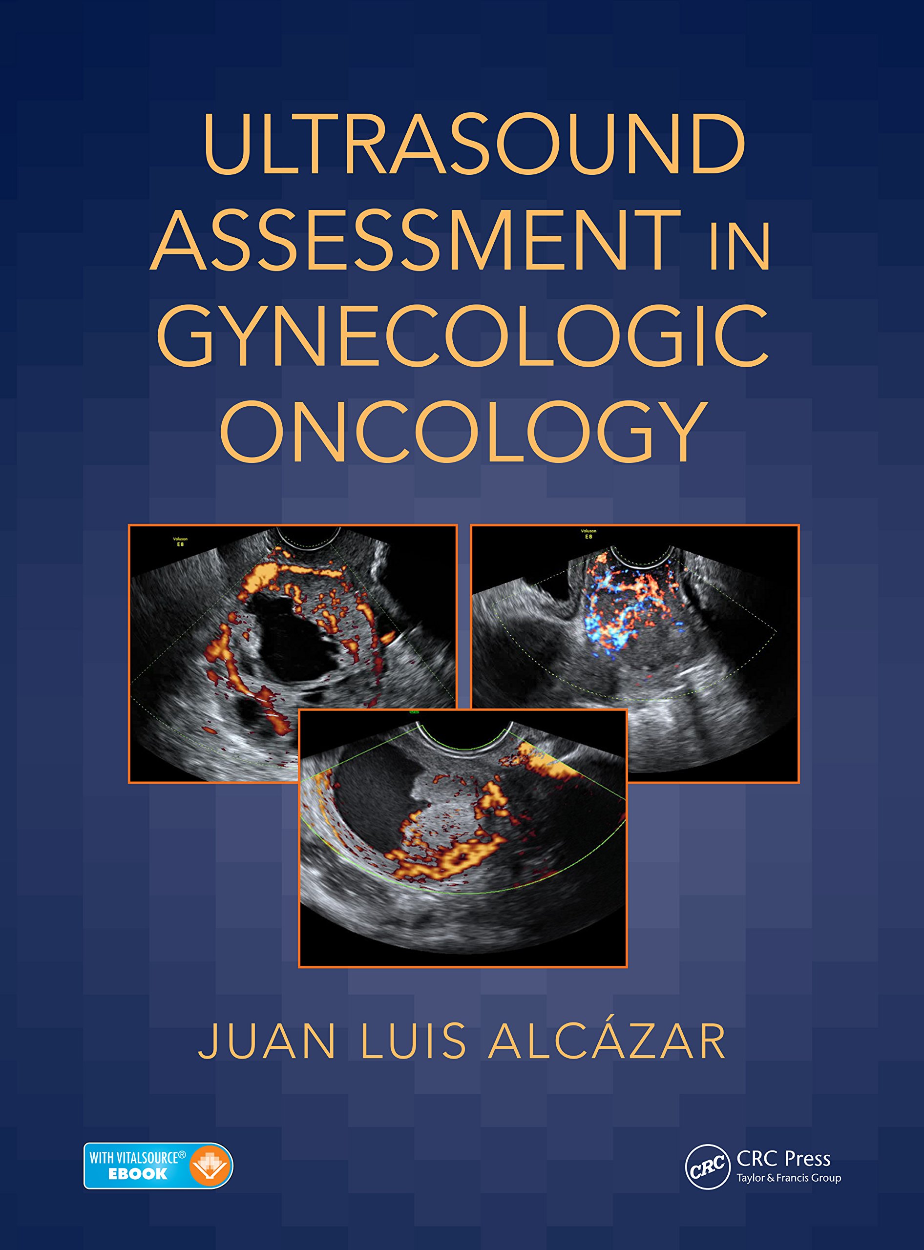 Ultrasound Assessment in Gynecologic Oncology ebook