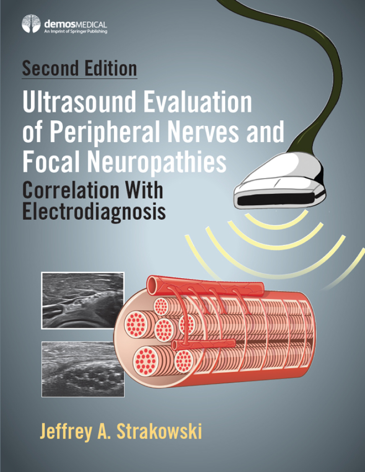 Ultrasound Evaluation of Peripheral Nerves and Focal Neuropathies, Se: 2nd Edition Correlation With Electrodiagnosis ebook