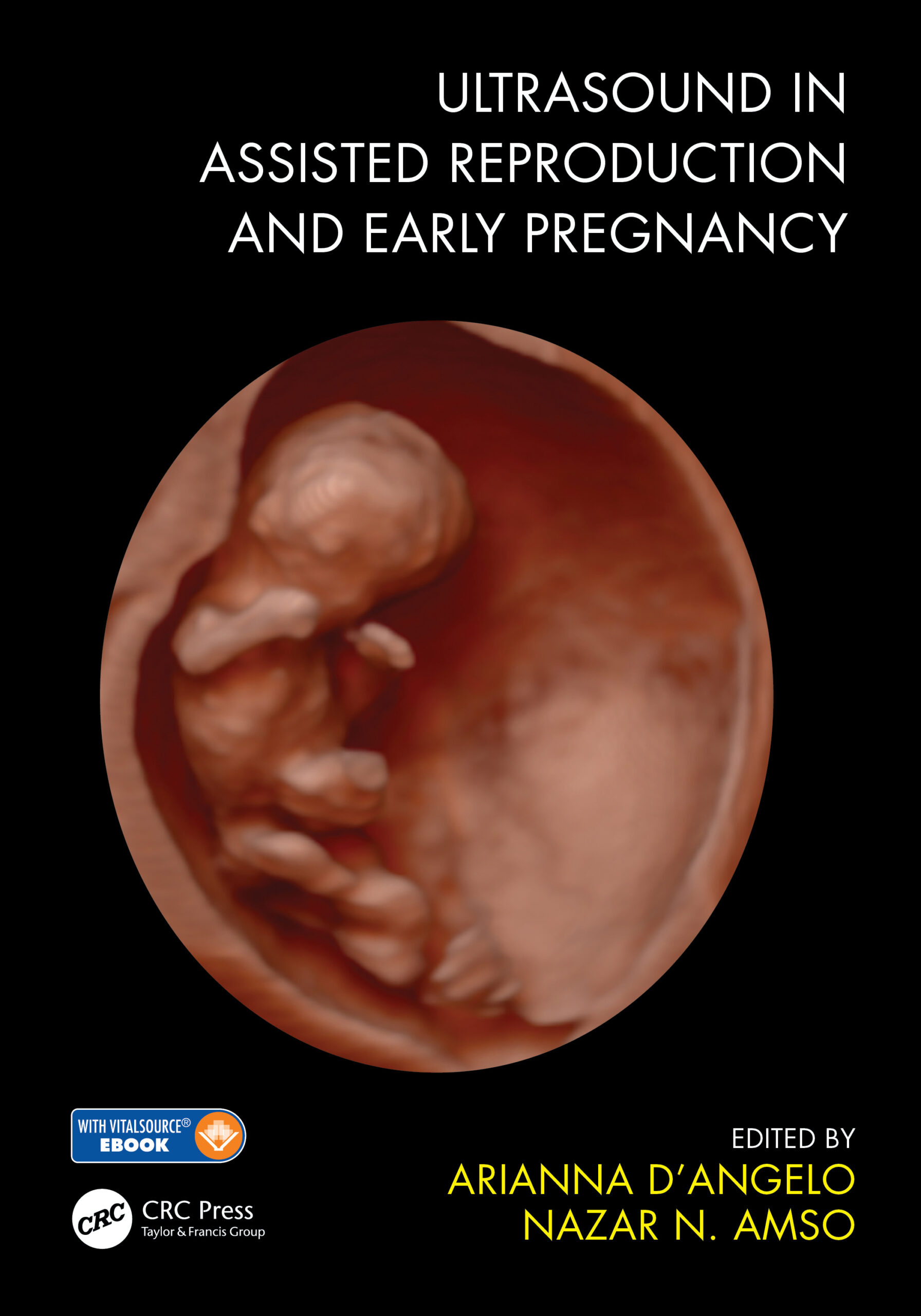 Ultrasound in Assisted Reproduction and Early Pregnancy ebook