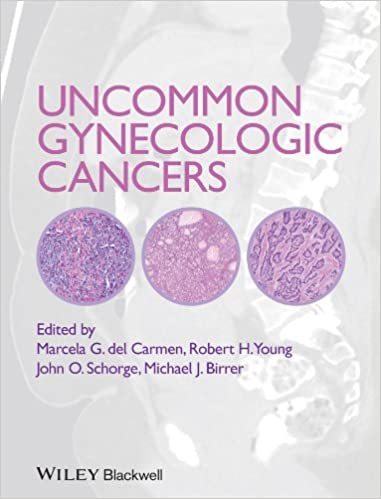 Uncommon Gynecologic Cancers ebook