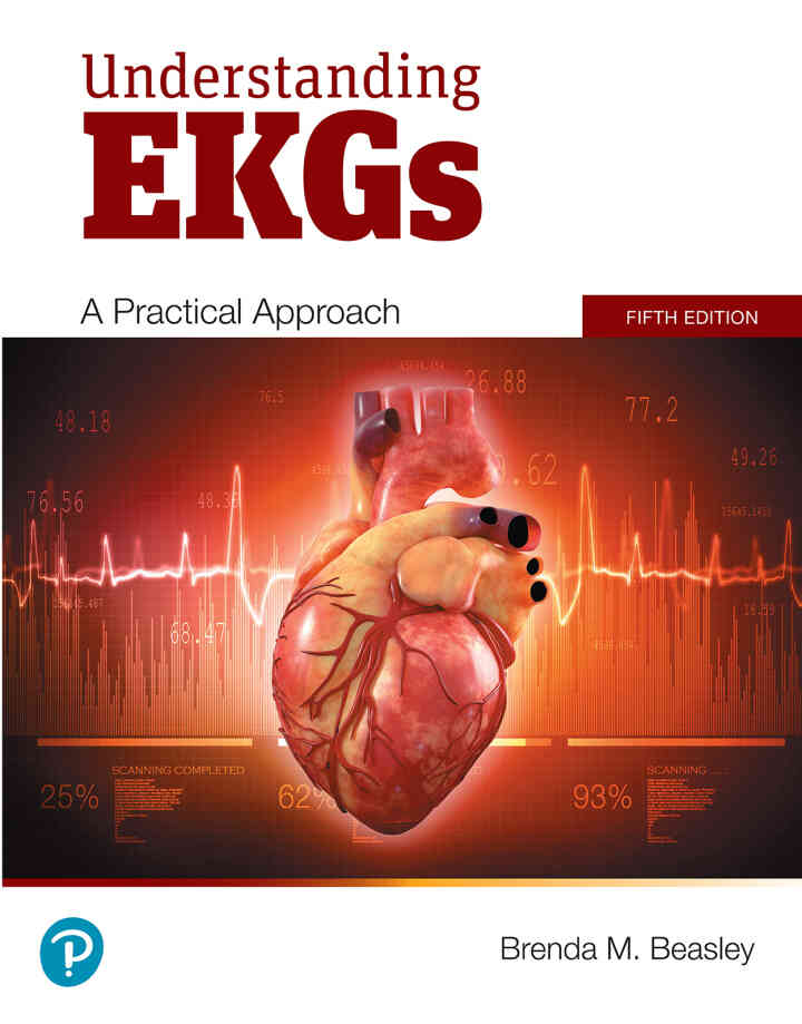 Understanding EKGs: A Practical Approach, 5th Edition ebook