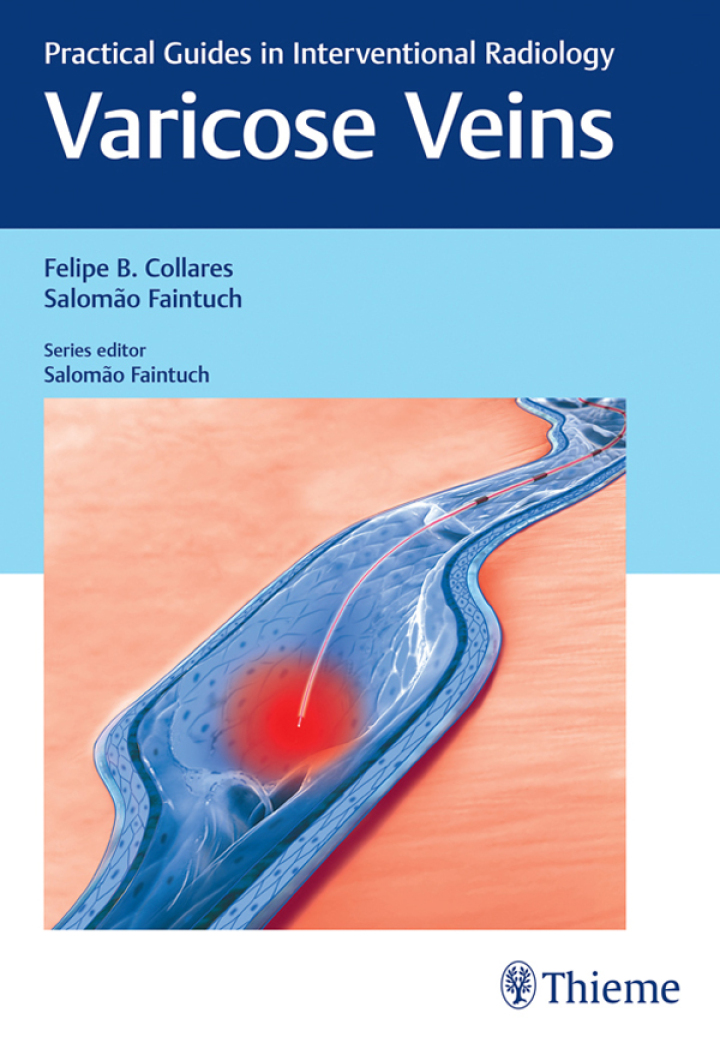 Varicose Veins: Practical Guides in Interventional Radiology ebook