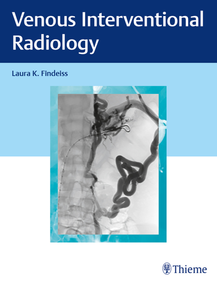 Venous Interventional Radiology ebook