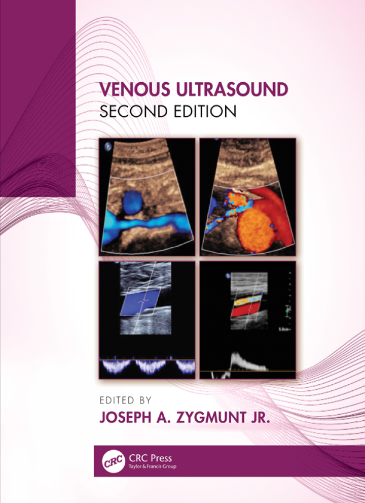 Venous Ultrasound ebook