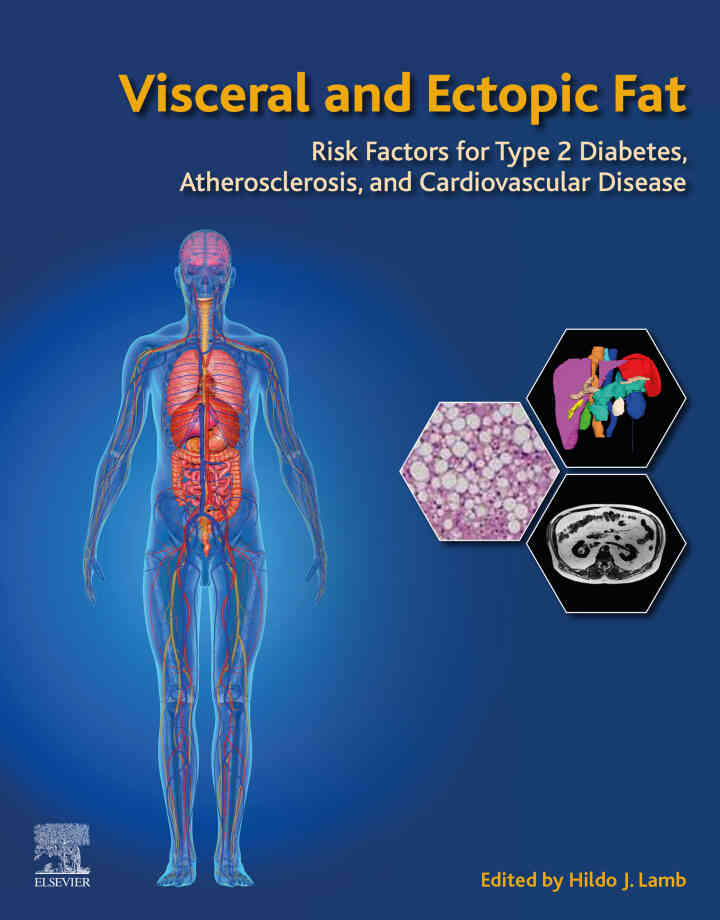 Visceral and Ectopic Fat: Risk Factors for Type 2 Diabetes, Atherosclerosis, and Cardiovascular Disease ebook