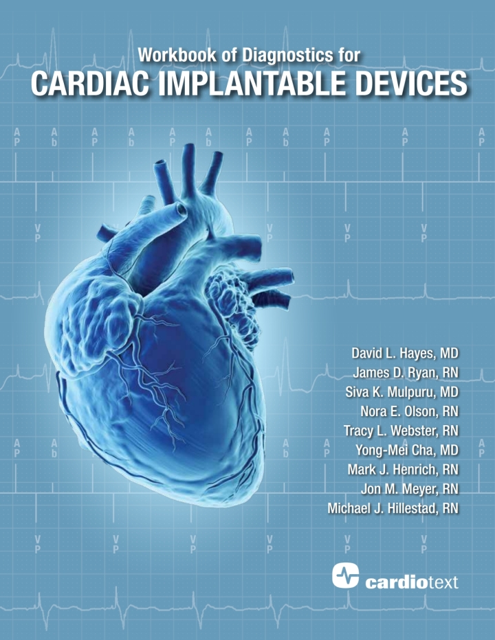 Workbook of Diagnostics for Cardiac Implantable Devices ebook