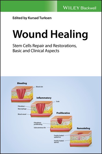 Wound Healing: Stem Cells Repair and Restorations, Basic and Clinical Aspects ebook