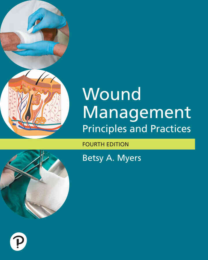 Wound Management: Principles and Practice, 4th Edition ebook