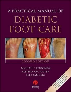 A Practical Manual of Diabetic Foot Care 2nd Edition by Michael E. Edmonds ebook