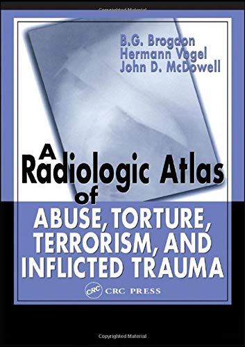 A Radiologic Atlas of Abuse, Torture, Terrorism, and Inflicted Trauma ebook