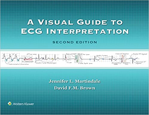 A Visual Guide to ECG Interpretation ebook