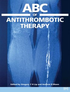 ABC of Antithrombotic Therapy by Gregory Y. H. Lip ebook