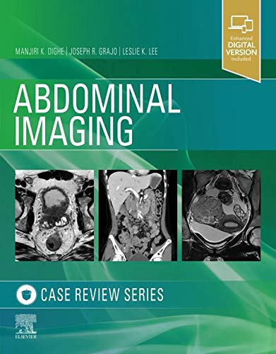 Abdominal Imaging: Case Review Series, 1st Edition ebook