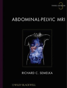 Abdominal-Pelvic MRI 3rd Edition, 2 Volume Set by Richard C. Semelka, M.D. ebook