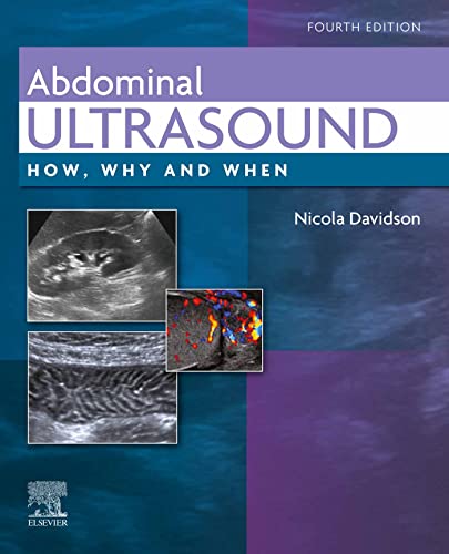 Abdominal Ultrasound: How, Why and When, 4th Edition ebook