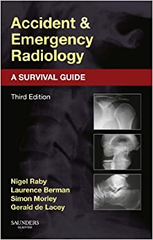 Accident and Emergency Radiology: A Survival Guide ebook
