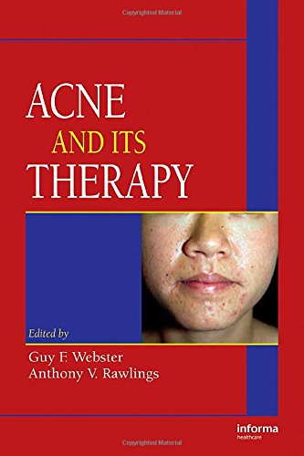 Acne and Its Therapy ebook