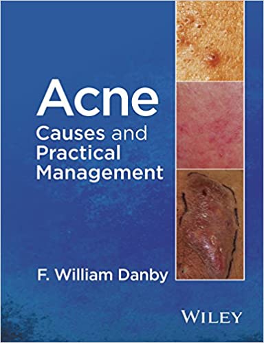 Acne: Causes and Practical Management ebook