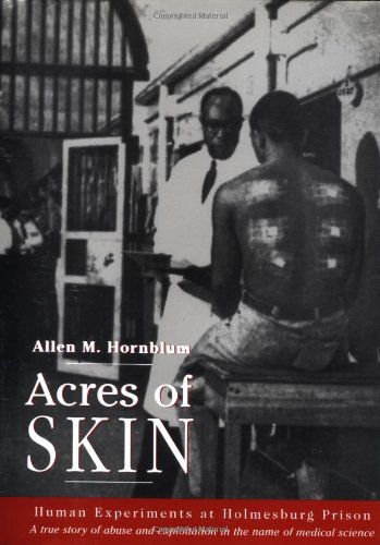 Acres of Skin ebook
