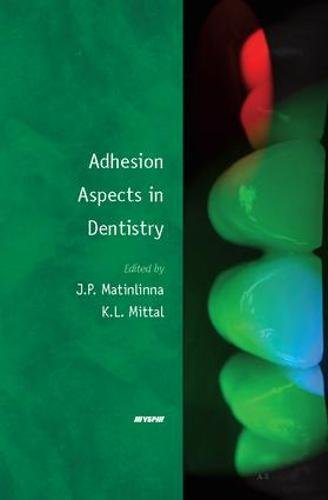 Adhesion Aspects in Dentistry ebook