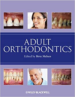 Adult Orthodontics ebook