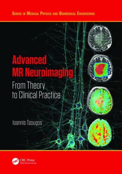 Advanced MR Neuroimaging: From Theory to Clinical Practice by Ioannis Tsougos ebook