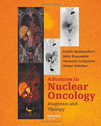 Advances in Nuclear Oncology ebook
