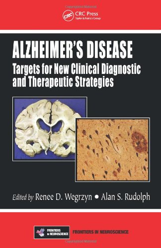 Alzheimer?s Disease ebook