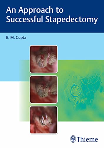 An Approach to Successful Stapedectomy ebook