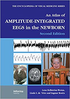 An Atlas of Amplitude-Integrated EEGs in the Newborn (Encyclopedia of Visual Medicine Series) ebook