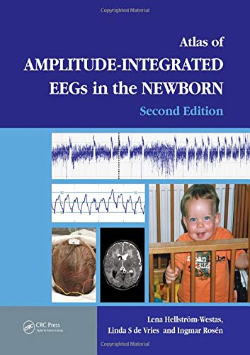 An Atlas of Amplitude-Integrated EEGs in the Newborn ebook
