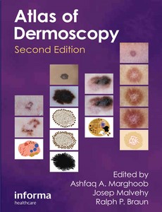 An Atlas of Dermoscopy, Second Edition by Ashfaq Marghoob ebook